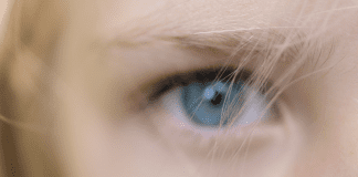 What Parents Need To Know About Trichotillomania
